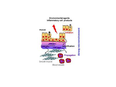 Schematic representation of the EMTU.  In asthma, epithelial susceptibility to damage initiates signals that are amplified by underlying fibroblasts and propagated into the deeper layers of the submuc